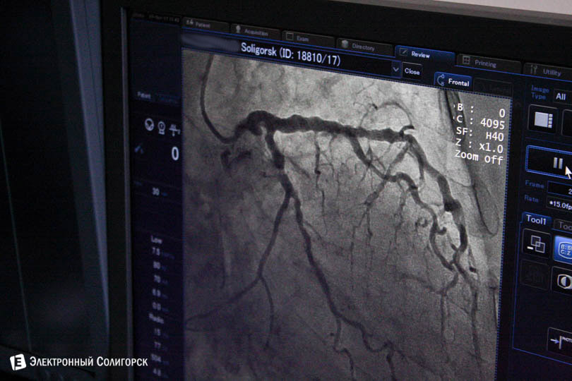 snimok2 angiograf soligorsk